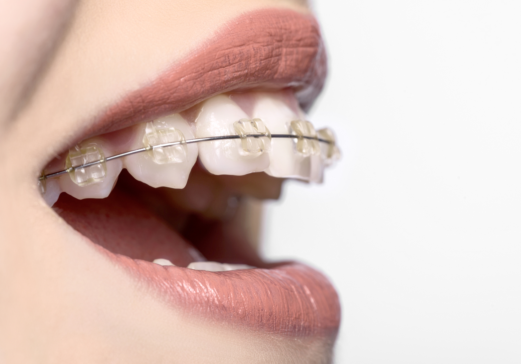 canine exposure periodontal orthodontics